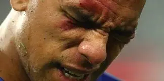 Hopoate hospitalised after head clash