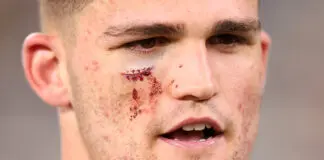 NRL Injuries: Cleary facing a week off, Welch HIA